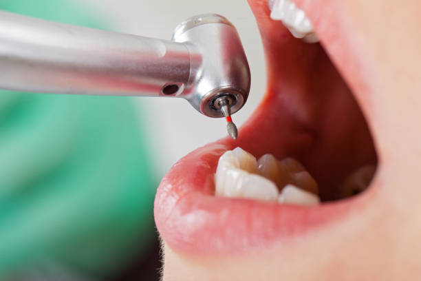 Best Emergency Denture Repair in Leavenworth, KS
